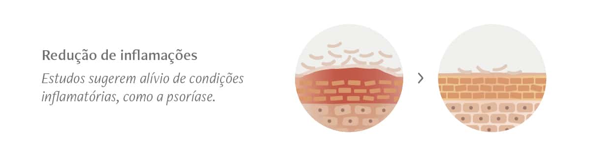 Possiveis efeitos na inflamacao cutanea e em doencas inflamatorias GLP-1