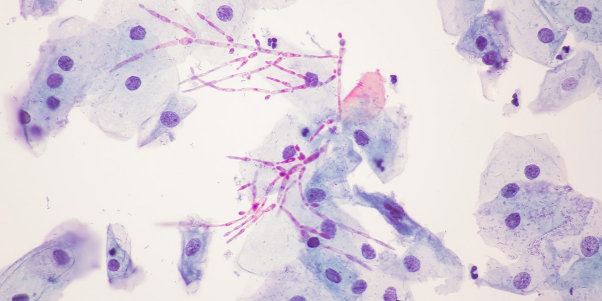 sinais de desequilibrio do microbioma intimo microbioma intimo